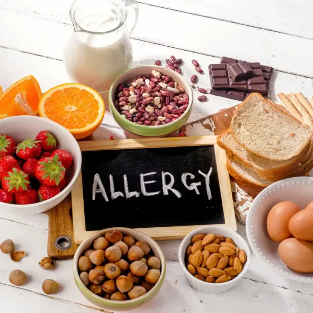 Alergy Awareness Training 1