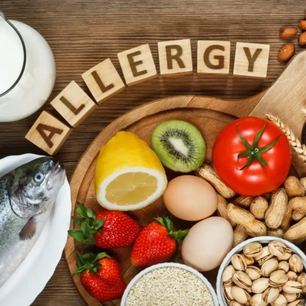 Alergy Awareness Training 2